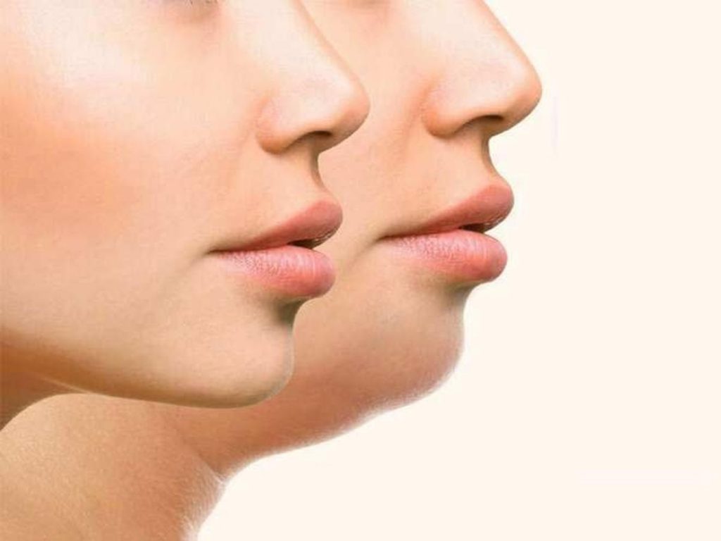 Lose Face Fat Now! Approaches For Women To Eliminate A Dual Face Making Sharp Beautiful Lines